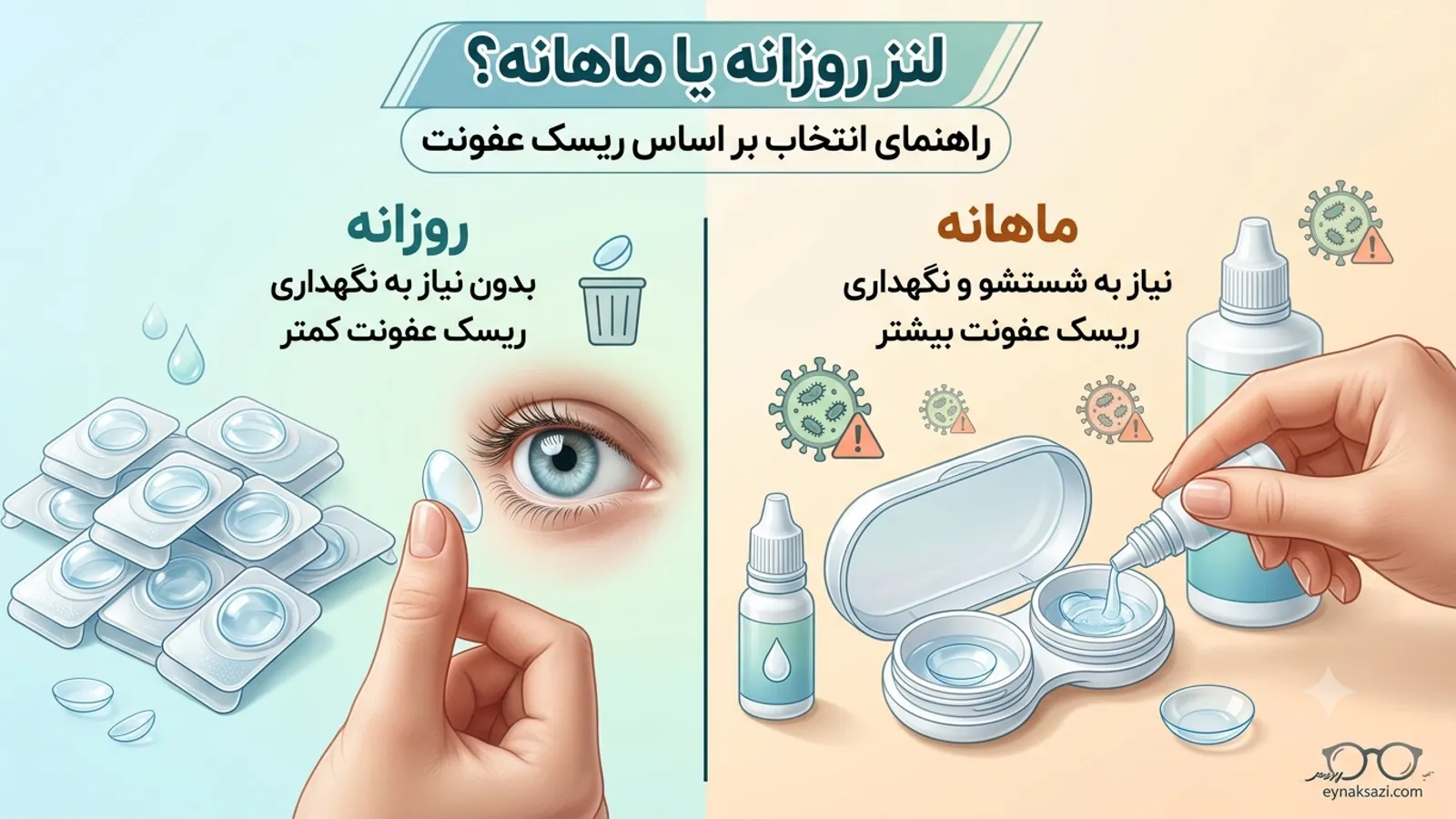 لنز روزانه یا ماهانه؟ راهنمای انتخاب بر اساس ریسک عفونت